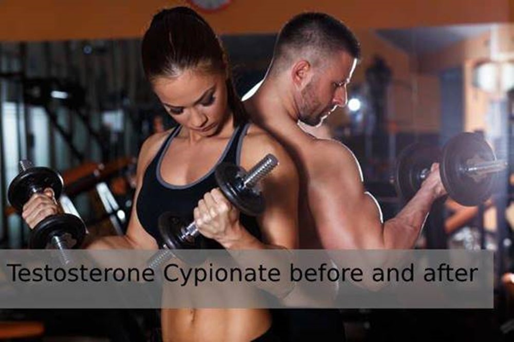 Testosterone Cypionate Before and After Its Intensive Use